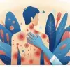 Protocol: Topical treatments for chronic plaque psoriasis