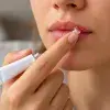 What are the benefits and risks of treatments for cold sores ?